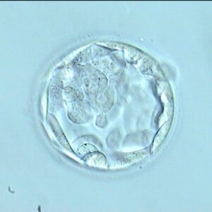 Embrión blastocisto. Transferir en día 4 o 5, selección natural