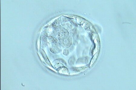 Embrión blastocisto. Transferir en día 4 o 5, selección natural