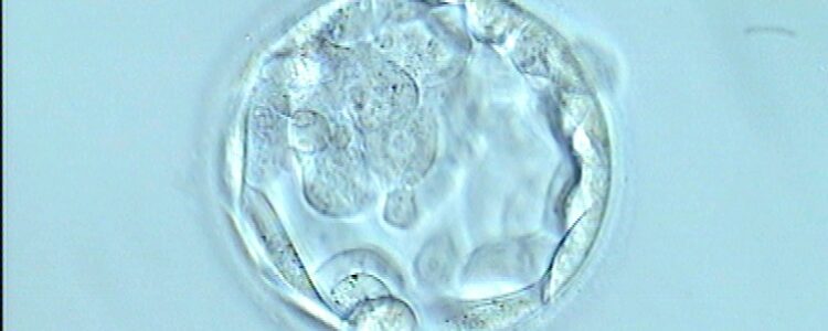 Embrión blastocisto. Transferir en día 4 o 5, selección natural