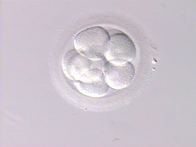 Embryoscope Embryoscope