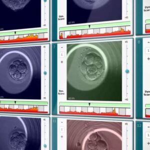 Embryoscope: La película del inicio de la vida