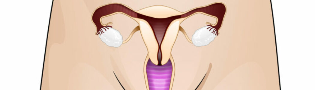 Endometriosis, adenomiosis e infertilidad