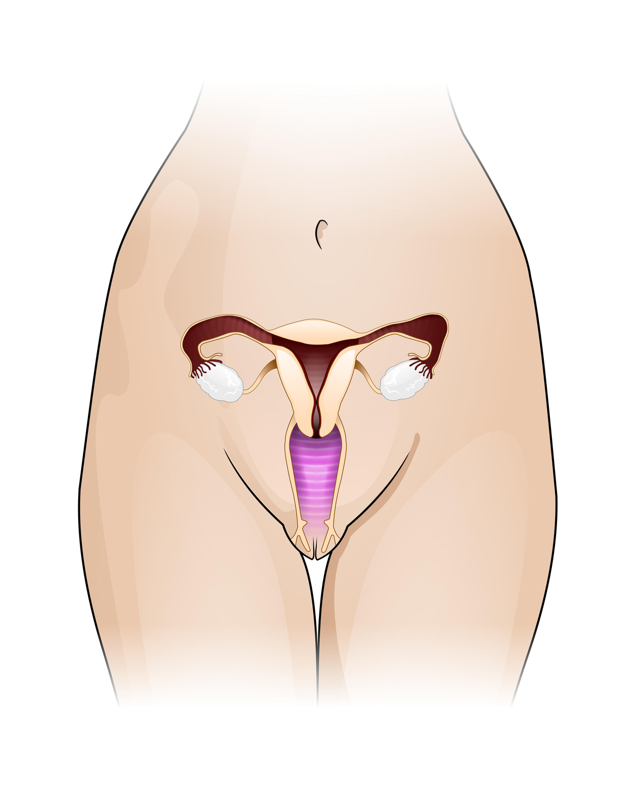Endometriosis, adenomiosis e infertilidad