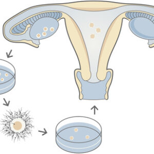 España es el cuarto país europeo donde más se realiza la reproducción asistida