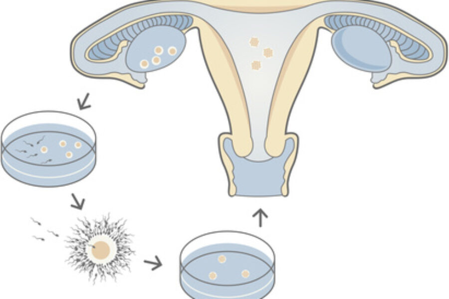 España es el cuarto país europeo donde más se realiza la reproducción asistida