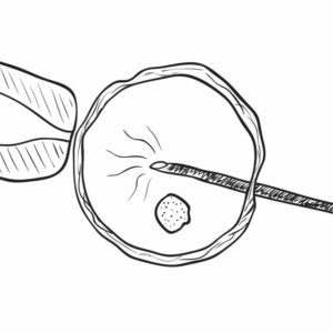 Estos son los sintomas que podrían aparecer tras una transferencia embrionaria Estos son los sintomas que podrían aparecer tras una transferencia embrionaria