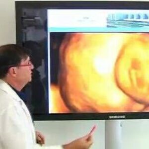 Extirpan un tumor de 168 gramos a un feto fuera del útero.