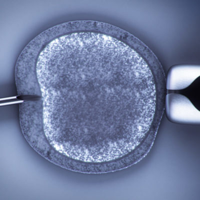 FIV - Fecundación in vitro