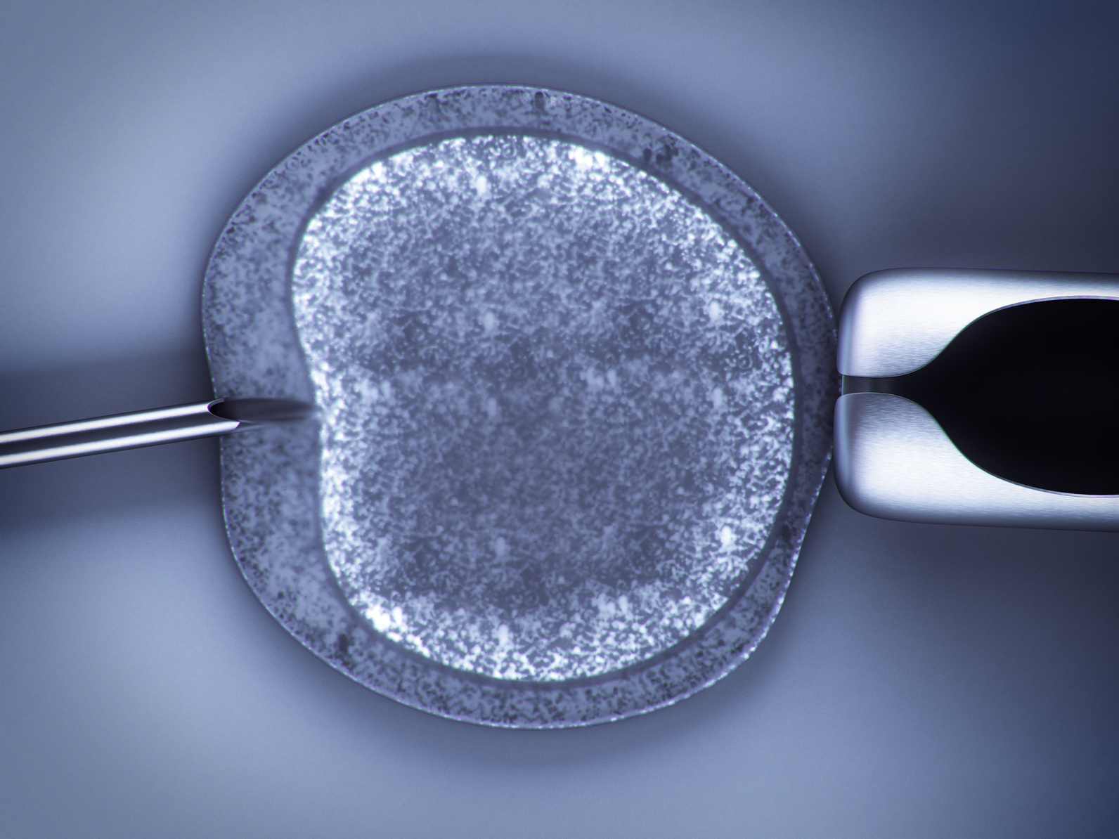 FIV - Fecundación in vitro
