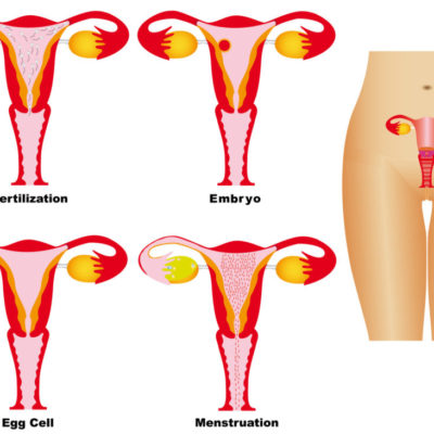 Fallo implantacional