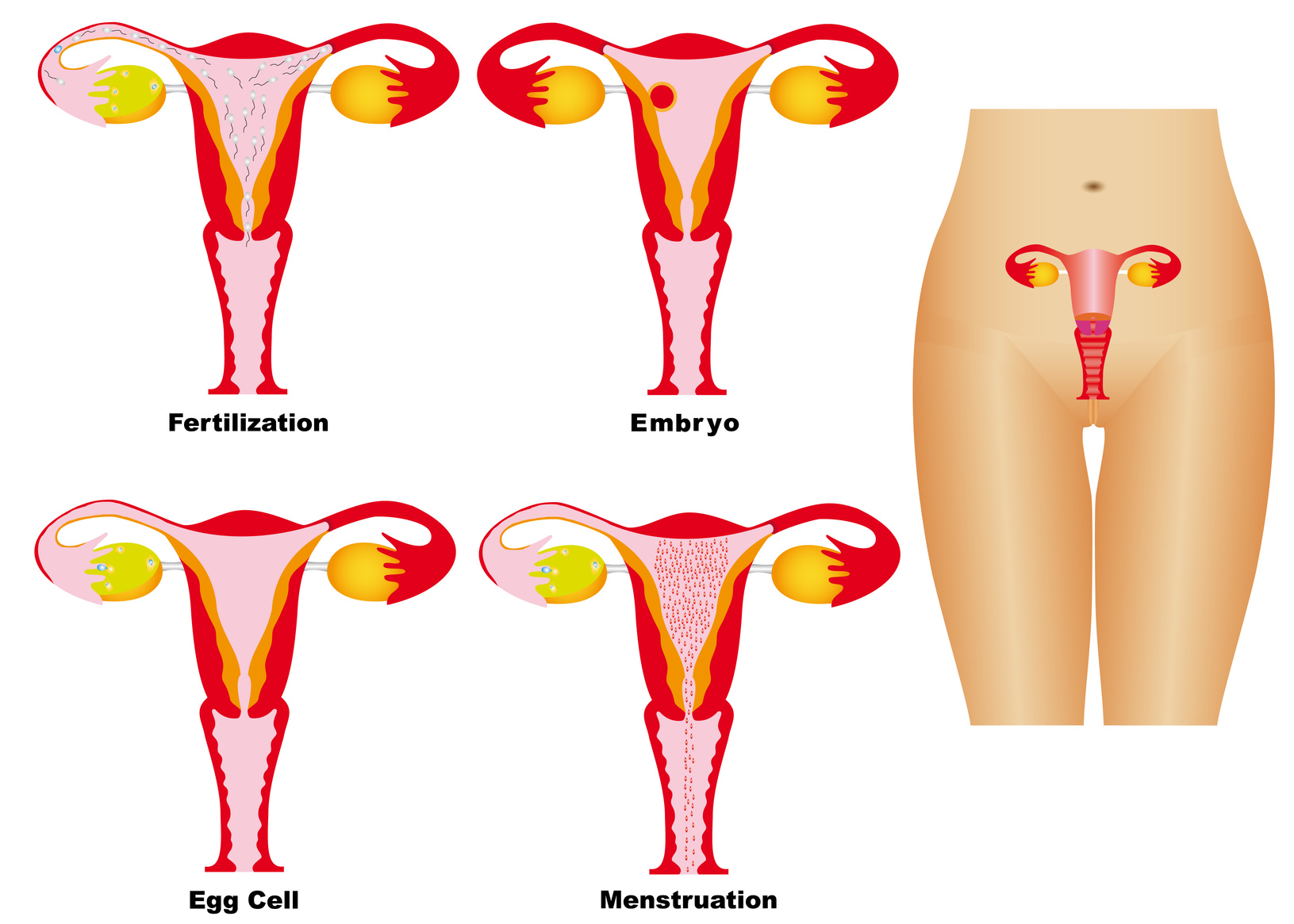 Fallo implantacional