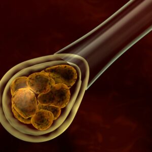 Fecundación » in vitro «