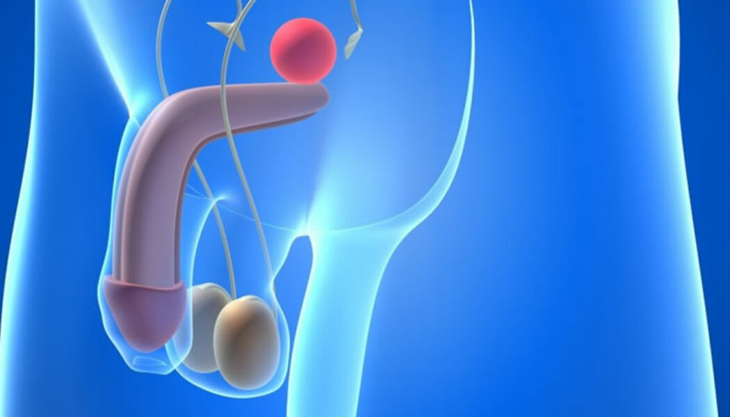 Fertilidad del varón en pacientes con cáncer testicular