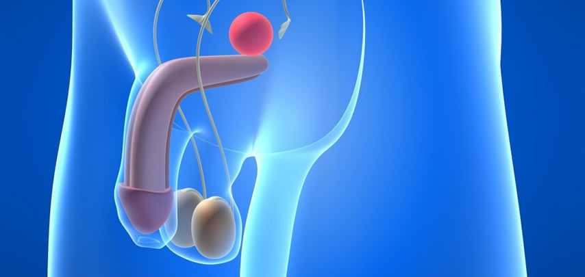 Fertilidad del varón en pacientes con cáncer testicular