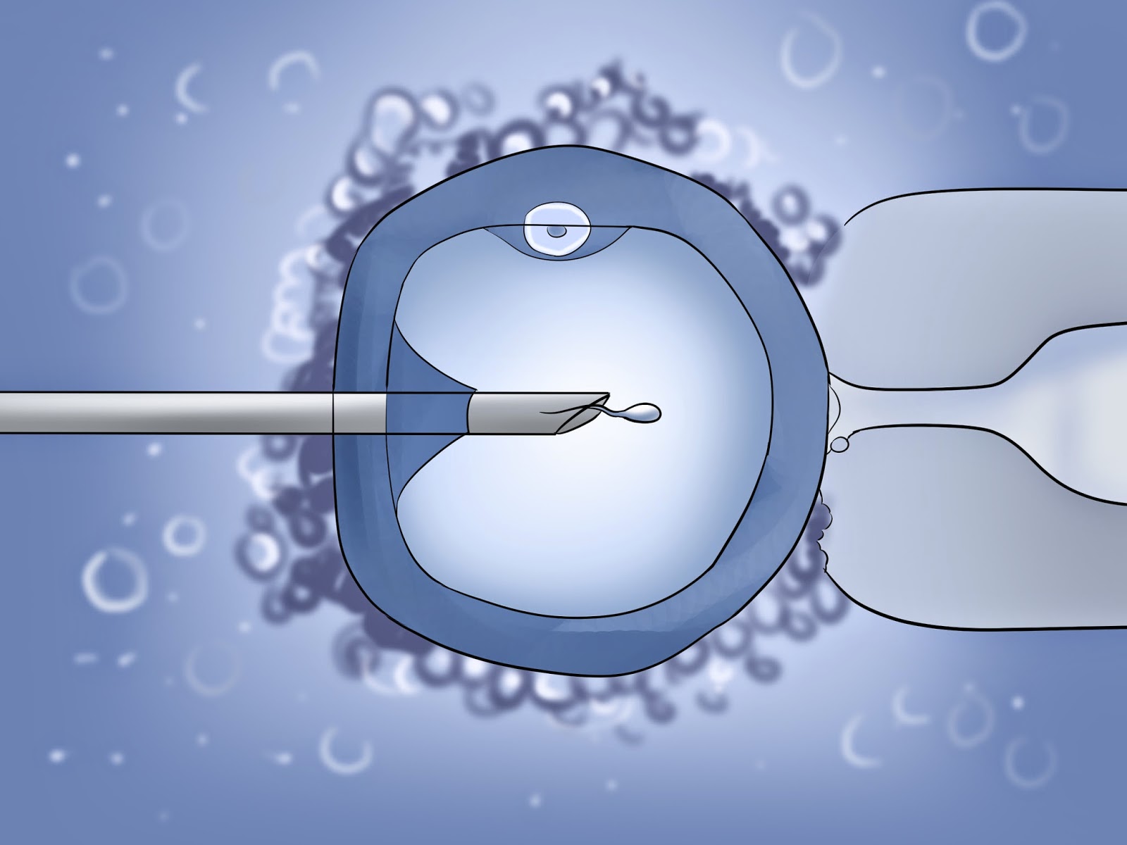 Fertilización in vitro. Se diseña una calculadora online para conocer las probabilidades de éxito