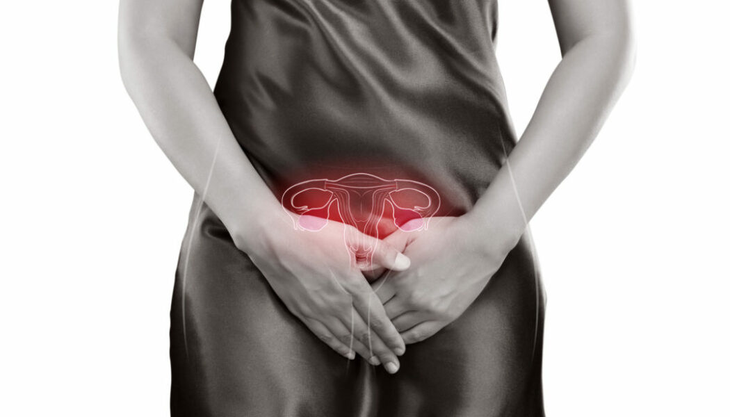Síndrome de Ovarios Poliquísticos: ¿Qué es y qué síntomas provoca?