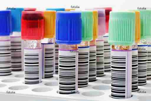 Funiculocentesis Funiculocentesis