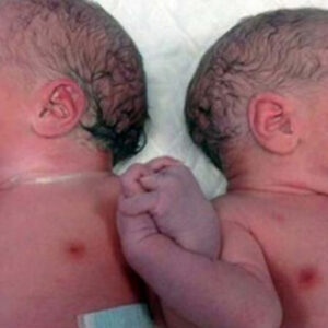 Habla una enfermera: «no les podíamos soltar las manos»