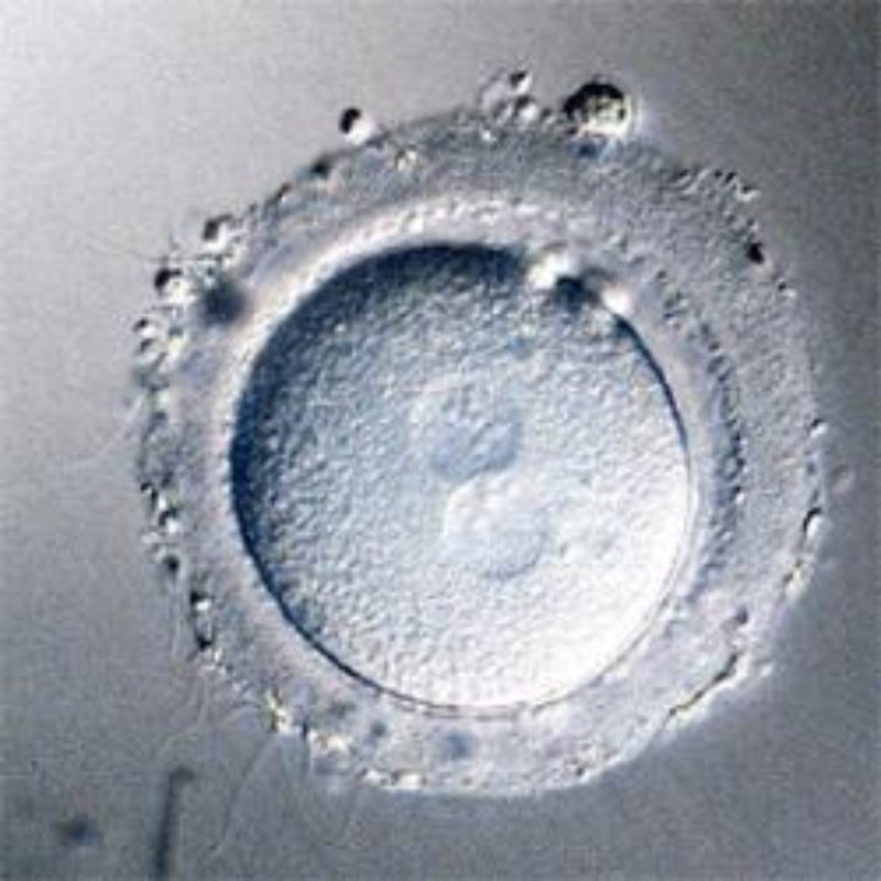 Hay un mayor interés por la transferencia de embriones en casos de esterilidad femenina.