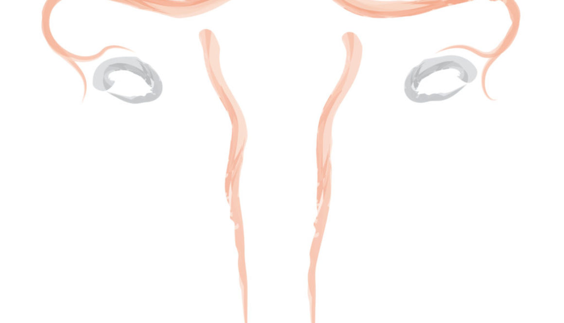 Histerosalpingosonografía