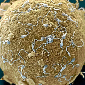 Infertilidad y sistema inmune: identifican nuevas relaciones