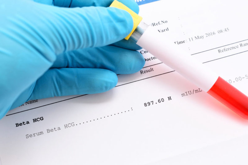 Ingresa en un hospital de Murcia una niña de 12 años embarazada