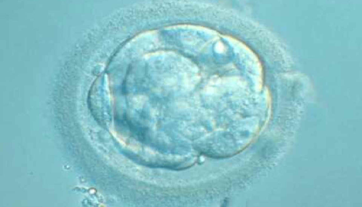 Investigación IB: Diferencias cromosómicas entre ovocitos en edad madura y ovocitos jóvenes procedentes de ovodonantes