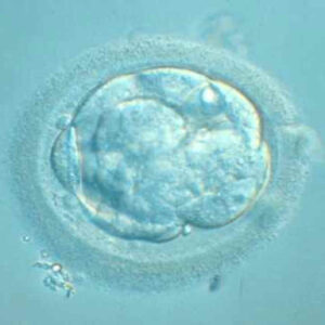 Investigación IB: Diferencias cromosómicas entre ovocitos en edad madura y ovocitos jóvenes procedentes de ovodonantes