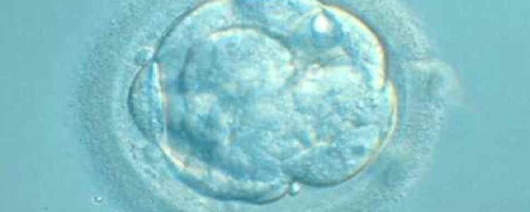 Investigación IB: Diferencias cromosómicas entre ovocitos en edad madura y ovocitos jóvenes procedentes de ovodonantes