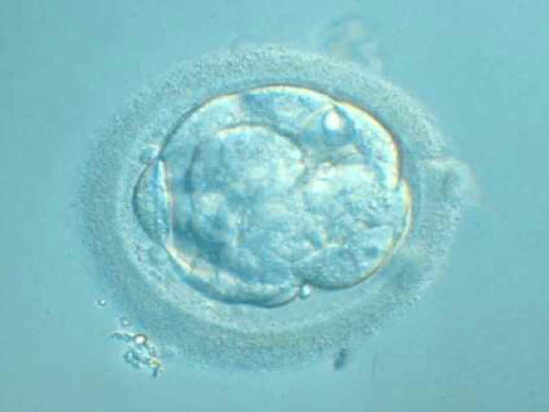 Investigación IB: Diferencias cromosómicas entre ovocitos en edad madura y ovocitos jóvenes procedentes de ovodonantes
