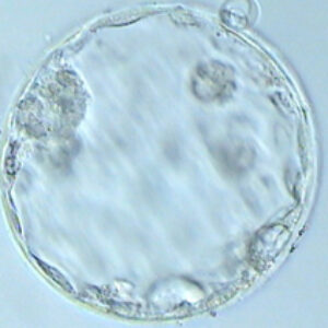 Investigación IB: El CCS como solución a las alteraciones cromosómicas en los embriones aneuploides asociados a la edad materna
