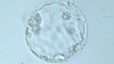 Investigación IB: El CCS como solución a las alteraciones cromosómicas en los embriones aneuploides asociados a la edad materna