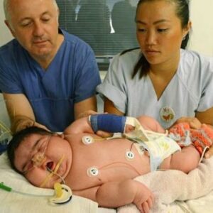 Jasleen, el bebé récord de Alemania: mide 57,4 centímetros y pesa 6,1 kilos