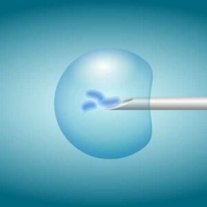 La Fecundación «In Vitro» no presenta un mayor riesgo de desarrollar un cáncer de mama o ginecológico