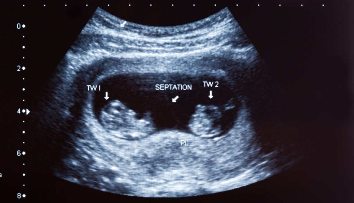 La UR Vistahermosa explica por qué es importante evitar los embarazos múltiples