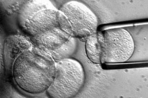 La calidad de un embrión