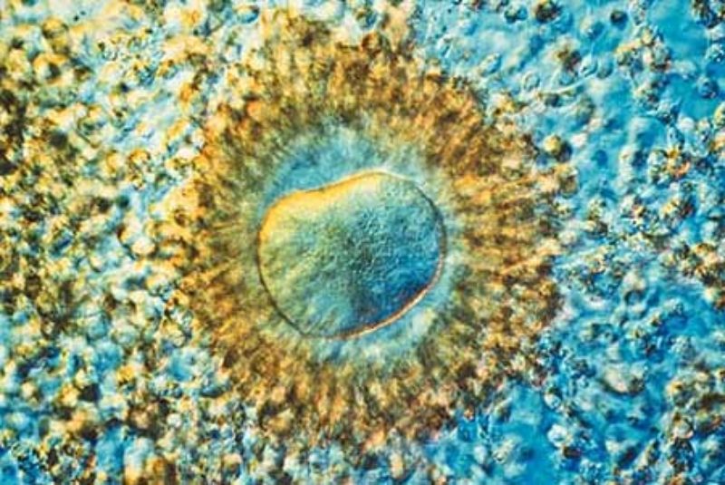 La ciencia pone a disposición de las mujeres infértiles numerosas opciones para hacer posible su sueño de ser padres.