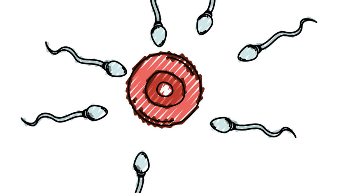 La fragmentación del ADN espermático presente en muchos abortos de repetición y fallos de implantación