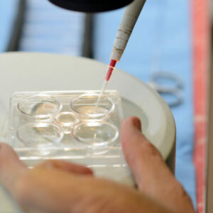 La hormona antimuleriana para medir la fertilidad