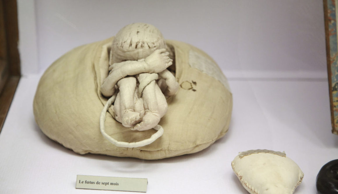 La matrona que salvó miles de vidas con un útero de trapo