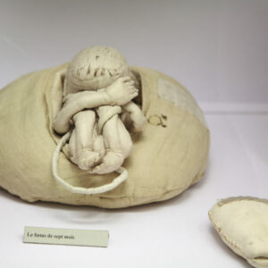 La matrona que salvó miles de vidas con un útero de trapo