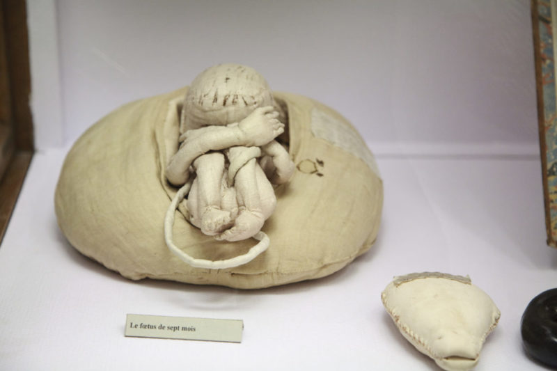 La matrona que salvó miles de vidas con un útero de trapo