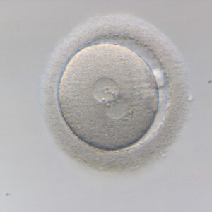 La transferencia de blastocitos