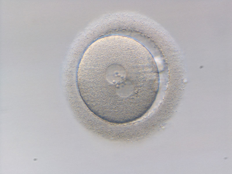La transferencia de blastocitos