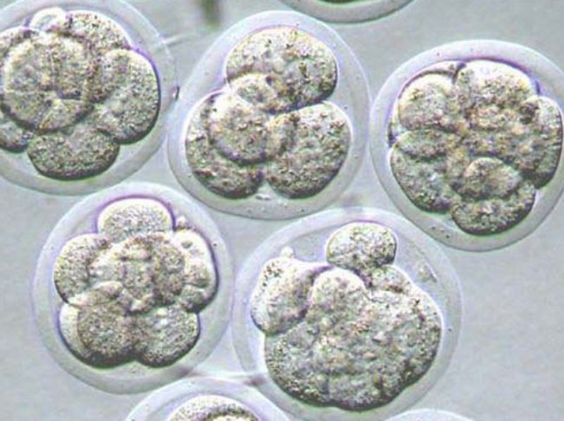 La transferencia de un sólo embrión es la mejor opción para las futuras mamás y los bebés