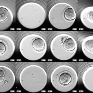 Los incubadores TIME-LAPSE con cámaras individuales aumentan el éxito en Reproducción Asistida Los incubadores TIME-LAPSE con cámaras individuales aumentan el éxito en Reproducción Asistida