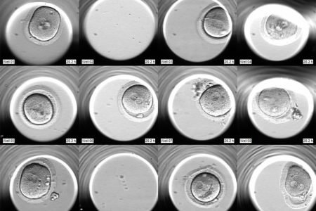 Los incubadores TIME-LAPSE con cámaras individuales aumentan el éxito en Reproducción Asistida