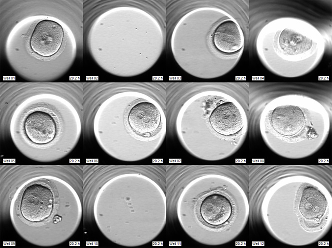 Los incubadores TIME-LAPSE con cámaras individuales aumentan el éxito en Reproducción Asistida