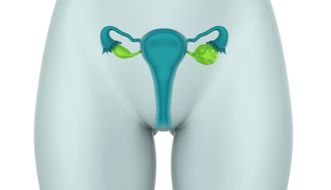 Los pólipos endometriales: Síntomas