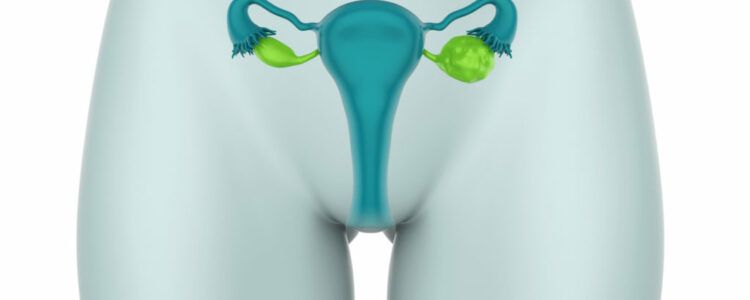 Los pólipos endometriales: Síntomas,diagnóstico y tratamientos